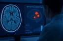 En el Instituto de Física e Ingeniería de Moscú (MIFI) se ha desarrollado un sistema de IA para el diagnóstico rápido y preciso de metástasis mediante resonancia magnética