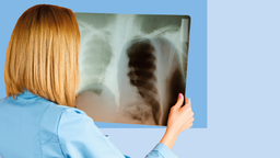 Российские ученые создали антибиотик, который убивает микобактерии внутри макрофагов