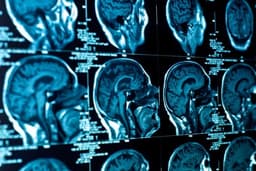 В Сколтехе разработали нанокапли для точной диагностики с помощью МРТ и УЗИ