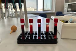 Ученые из Ставрополя создали инновационный состав для консервации крови