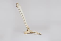 Учёные из России улучшили имплант для лечения рака кости 