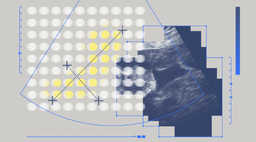Яндекс создал нейросеть для выявления редкой патологии на ранних сроках развития при беременности