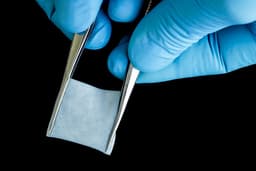 Сеченовский университет разработал новый материал для ускорения заживления полости рта после операций