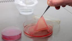 Ученые из Бурятии разработали аналог живой кожи: рывок в российской медицине