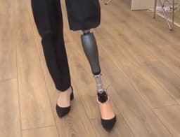 Российский бионический протез «Комета» с отечественной гидравликой: от танцев до лыж — без ограничений