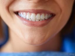 Укрепляет эмаль и устраняет бактерии: «cтоп кариес» покрытие разработали ученые в России