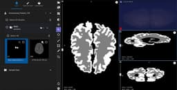 Новая нейросеть Яндекса ускоряет диагностику ДЦП у новорождённых с дней до считанных минут