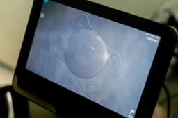 Yashen lens goes into production: domestic lens will eliminate glasses and correct astigmatism