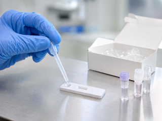 Monkeypox can be detected faster: Russia has patented a new test
