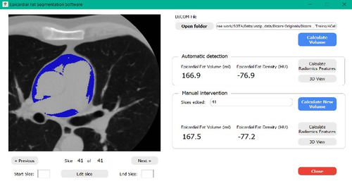 EPIFAT program interface: results of automatic analysis of epicardial adipose tissue