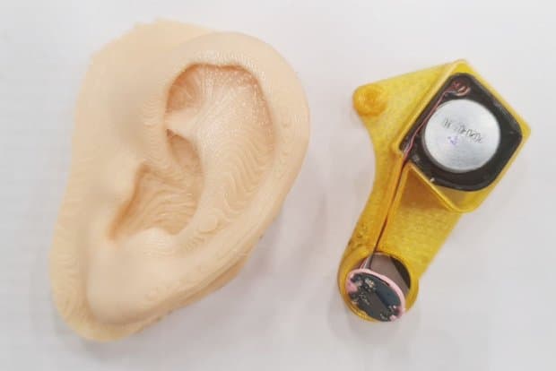протез уха