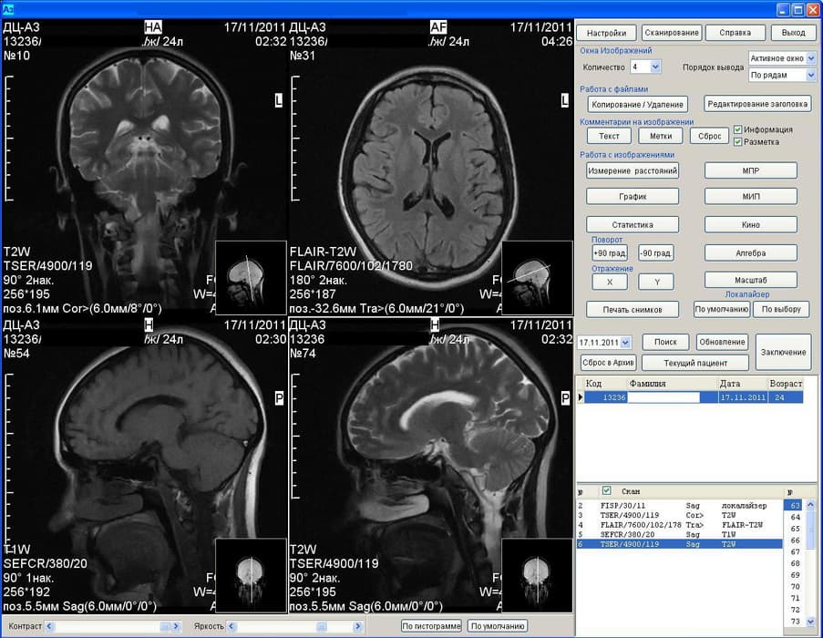 Results of the MRI machine Az-300